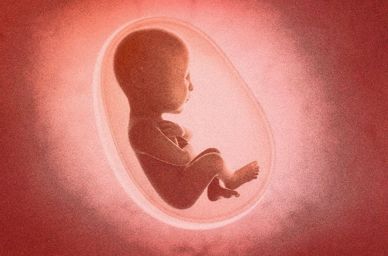 abortion